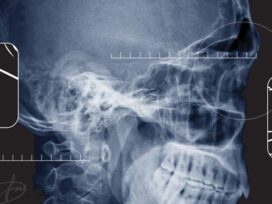How Can AI Help Transform Radiology?