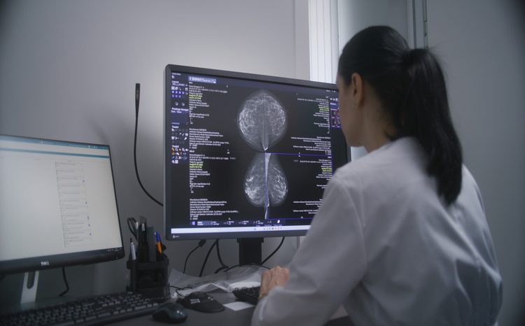 Prototype developed for new breast cancer detection technology