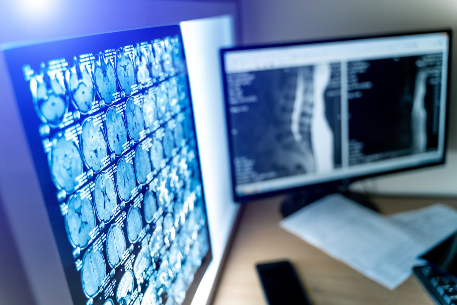 Radiology Revolution: NewVue.ai Meets MD.ai