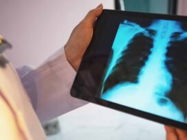 Viz.ai partners with Regeneron, Sanofi to study COPD tool