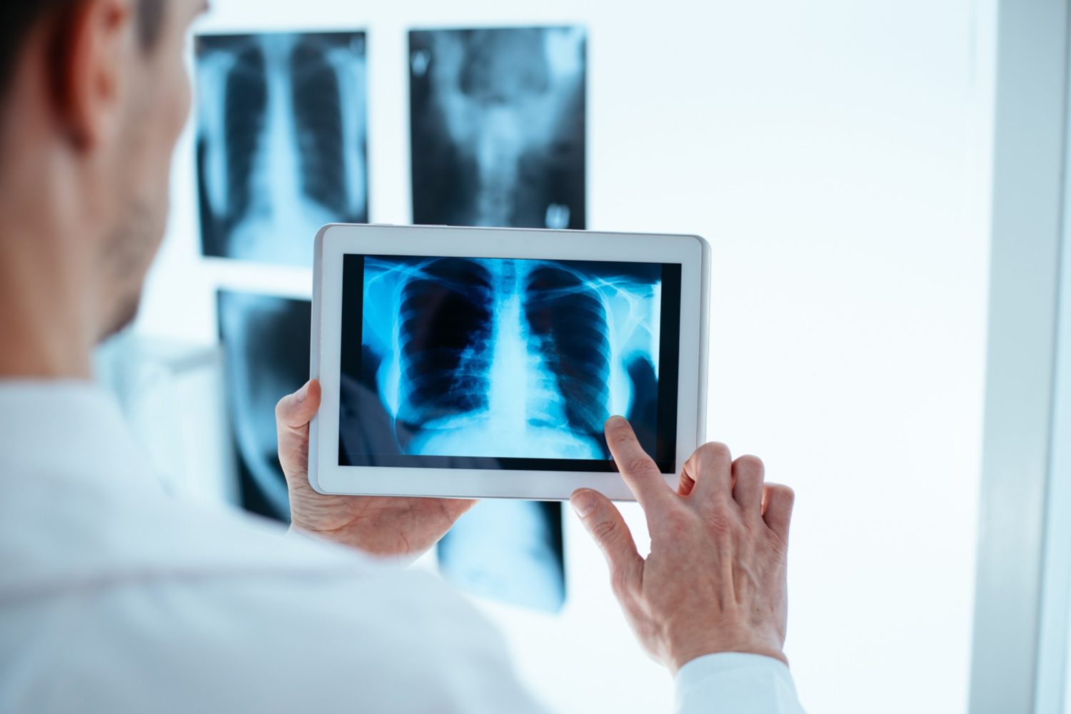 World’s Largest Chest X-Ray Dataset Launches