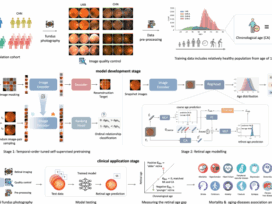 A cross population study of retinal aging biomarkers with longitudinal pre-training and label distribution learning