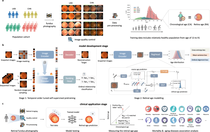 A cross population study of retinal aging biomarkers with longitudinal pre-training and label distribution learning