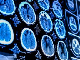 Barts Health deploys imaging de-identification tool
