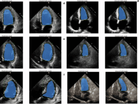 Foundation versus domain-specific models for left ventricular segmentation on cardiac ultrasound