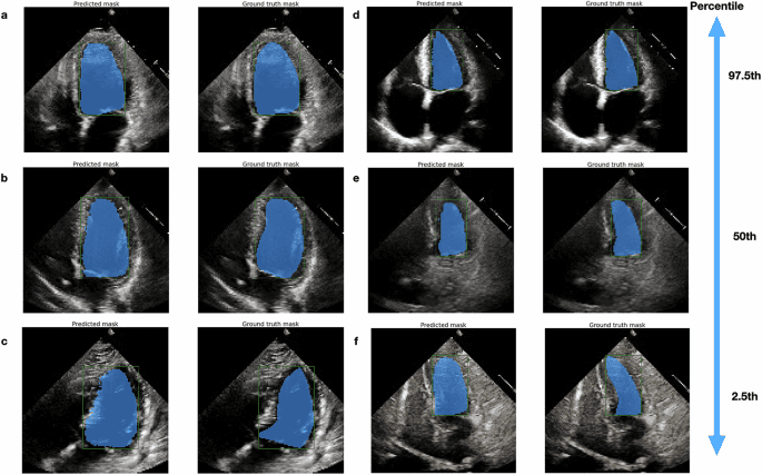 Foundation versus domain-specific models for left ventricular segmentation on cardiac ultrasound