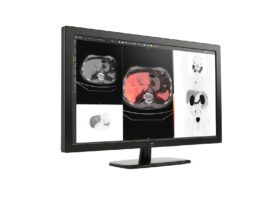GE HealthCare Integrates Advanced Features with MIM Encore Platform