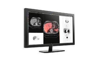 GE HealthCare Integrates Advanced Features with MIM Encore Platform