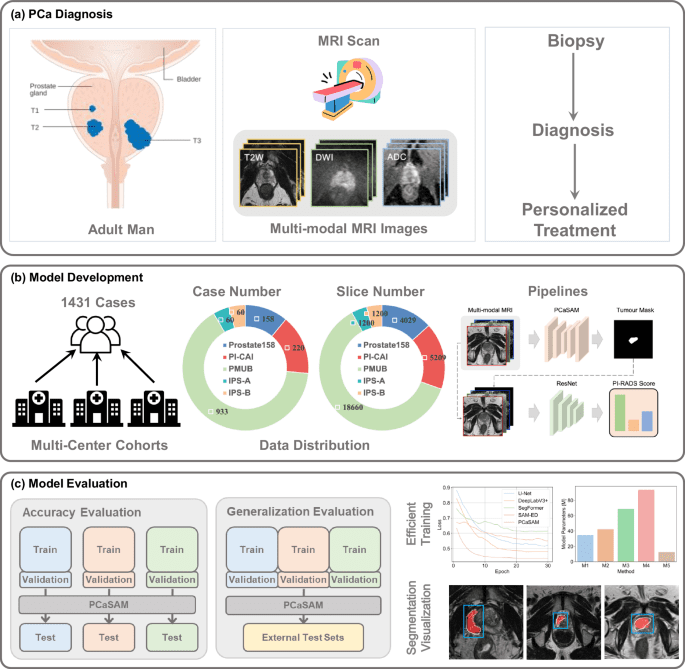 Generalist medical foundation model improves prostate cancer segmentation from multimodal MRI images