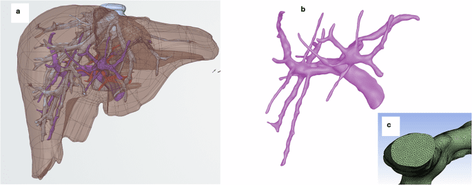 Multiscale modeling of drug-induced liver injury from organ to lobule