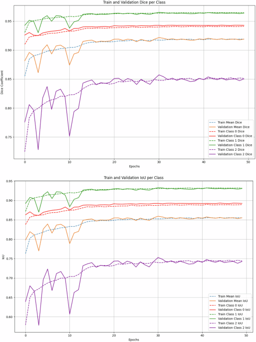 Automating liver biopsy segmentation with a robust, open-source tool for pathology research: the HOTSPoT model