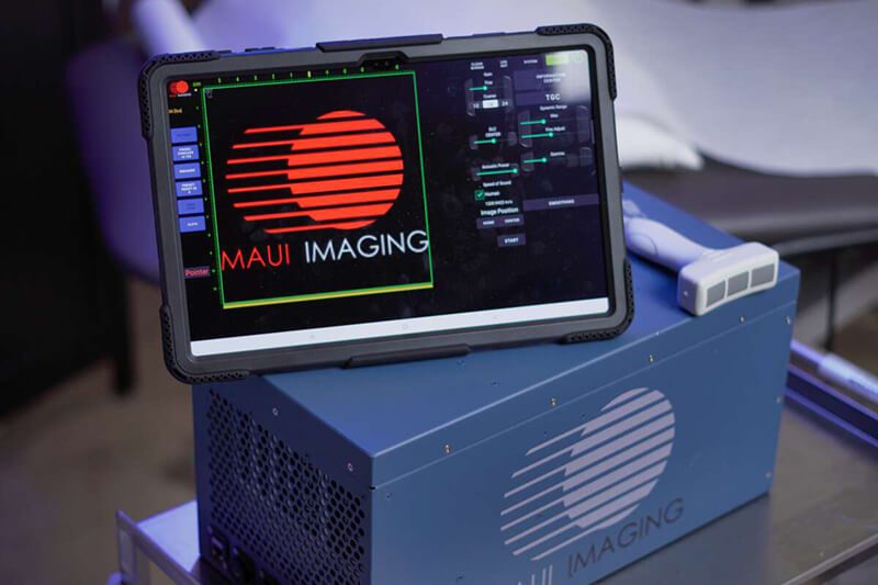 MAUI Imaging Secures $14M, Unveils Patented CET Ultrasound for Unseen Anatomy