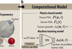 Physics-informed machine learning digital twin for reconstructing prostate cancer tumor growth via PSA tests