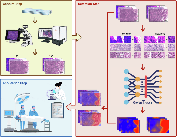 Transformer optimization with meta learning on pathology images for breast cancer lymph node micrometastasis