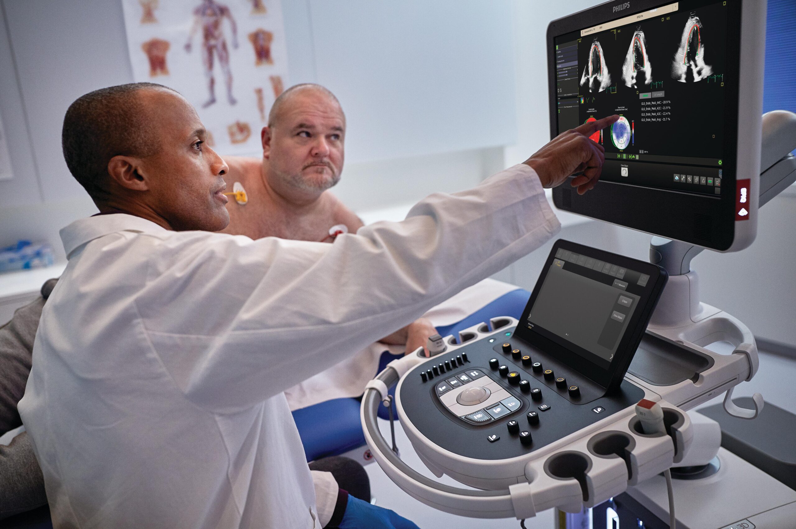 Philips Unveils Cardiovascular Ultrasound System with 26 AI Apps