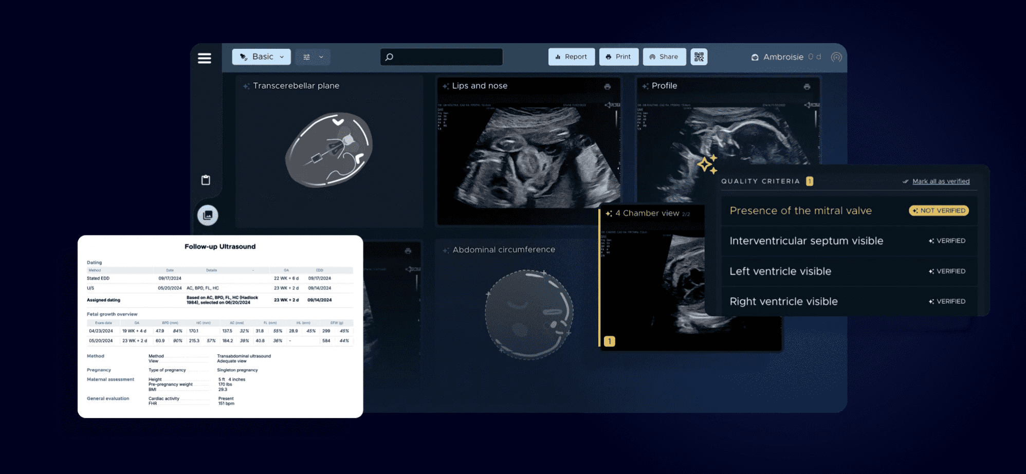 Sonio Launches New AI-Powered Product Suite to Enhance Maternal Healthcare in the U.S.