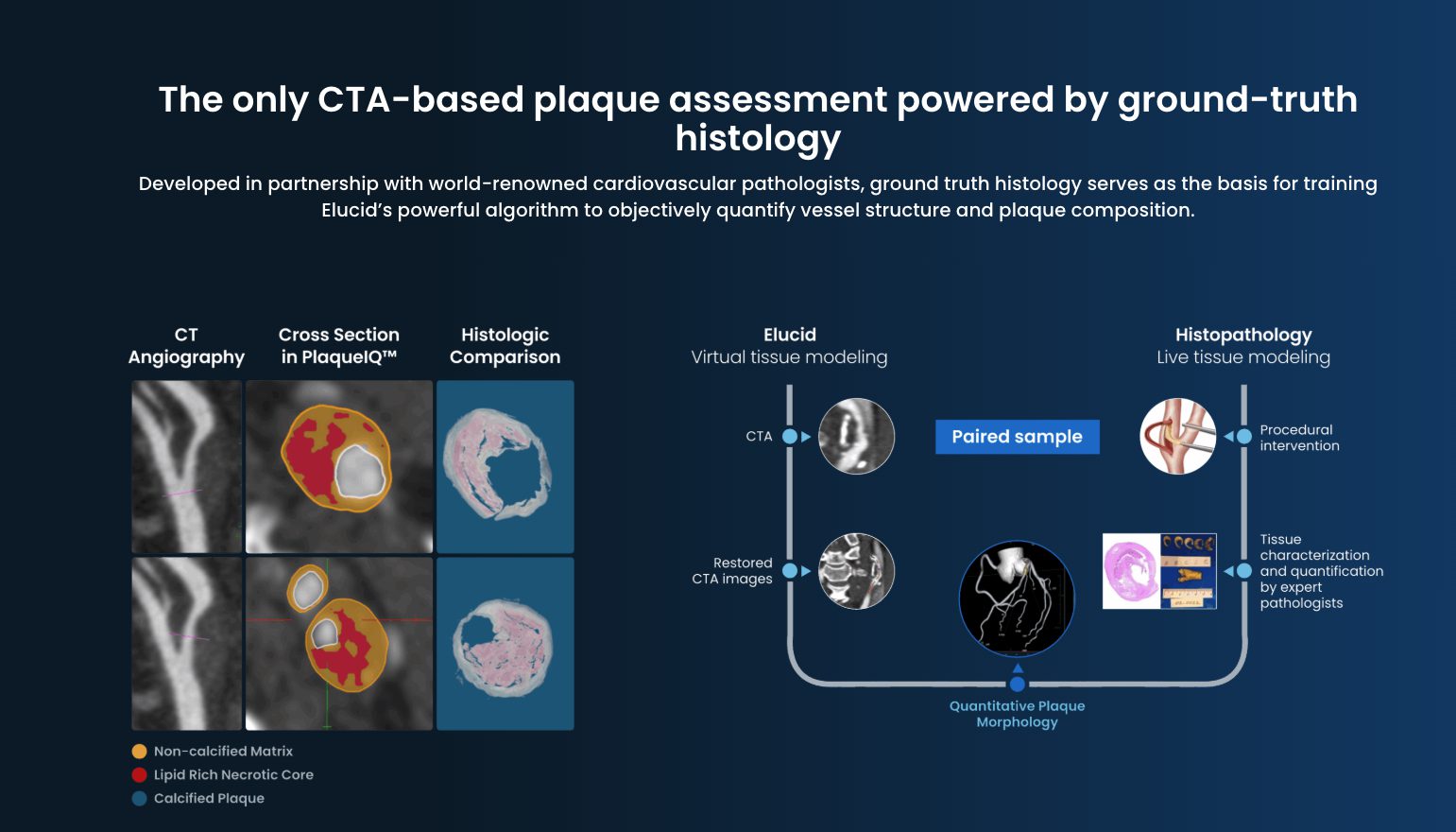 UnitedHealthcare to Cover Elucid’s PlaqueIQ CTA Plaque Analysis Starting 10/1