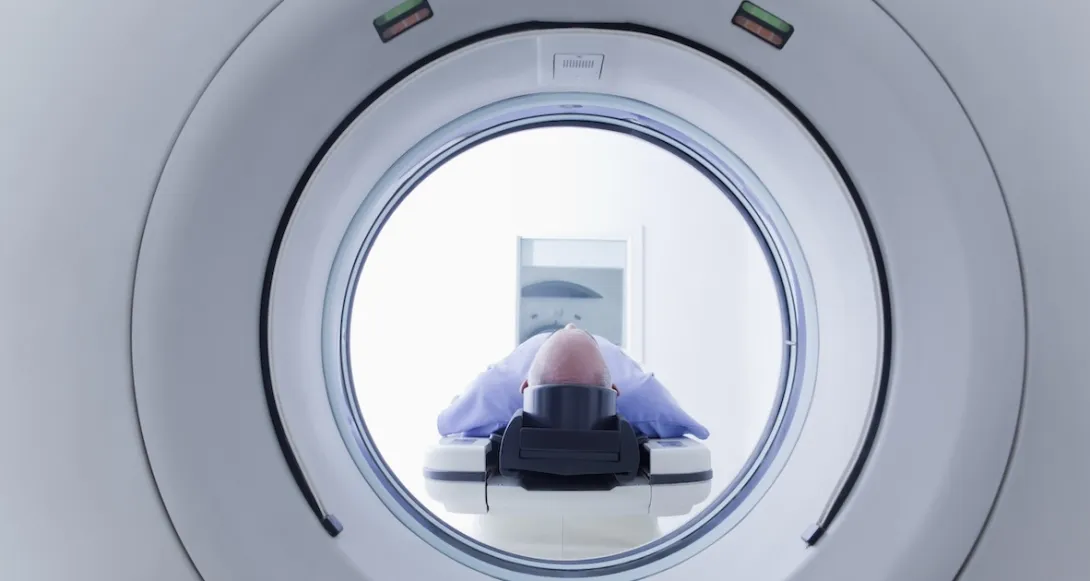 GE HealthCare's newest imaging AI to undergo provider testing 