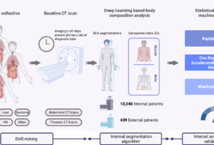Leveraging Sarcopenia index by automated CT body composition analysis for pan cancer prognostic stratification