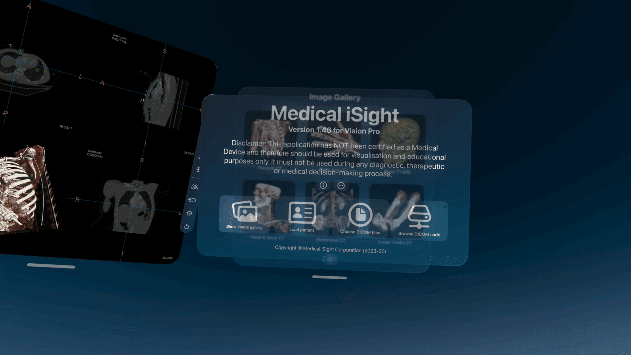 XRAIview Launches on Apple Vision Pro with Portable 3D DICOM Viewing