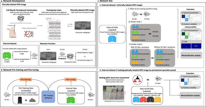 A novel AI-powered radiographic analysis surpasses specialists in stage II–IV periodontitis detection: a multicenter diagnostic study
