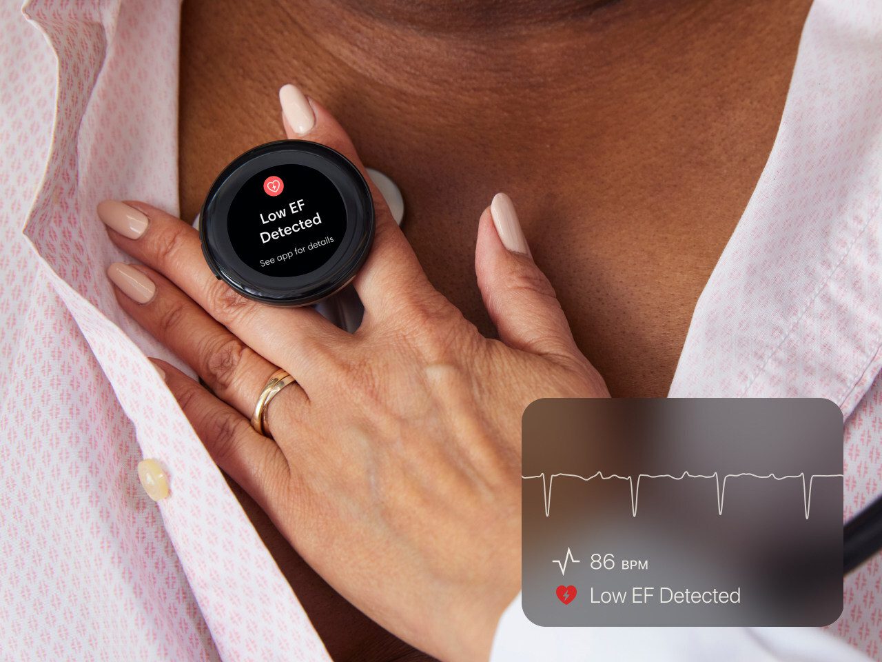 AI Digital Stethoscope Detects Heart Failure with Near-Echo Precision in Ghana