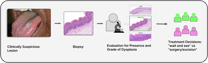 AI-driven prediction of progression to oral squamous cell carcinoma using a multiresolution pathology model