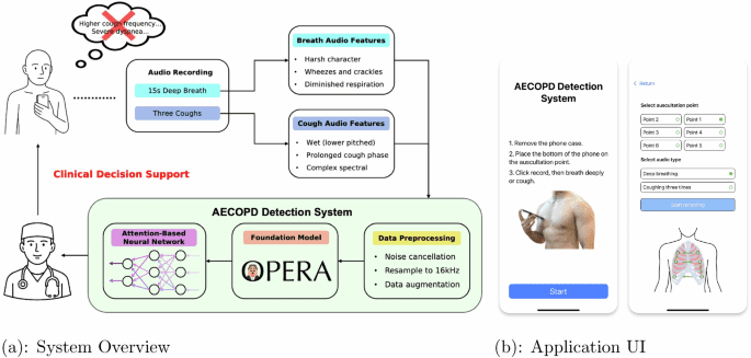 AI-driven smartphone screening for acute COPD exacerbations: enhancing health equity in developing regions