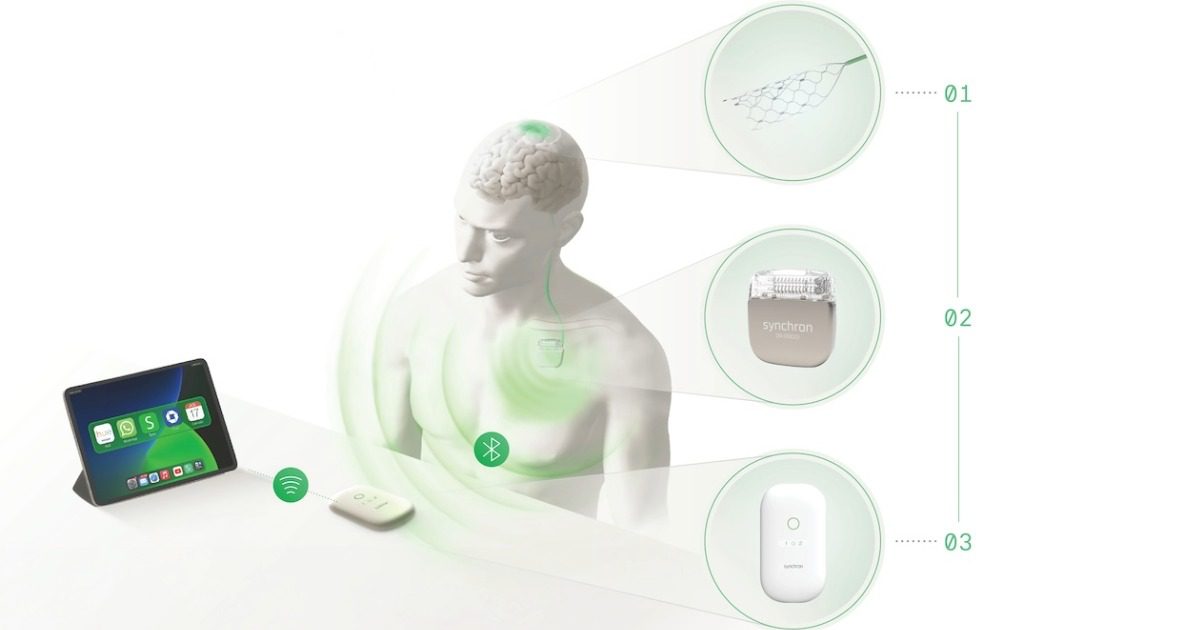 Brain-computer interface company Synchron raises $200M