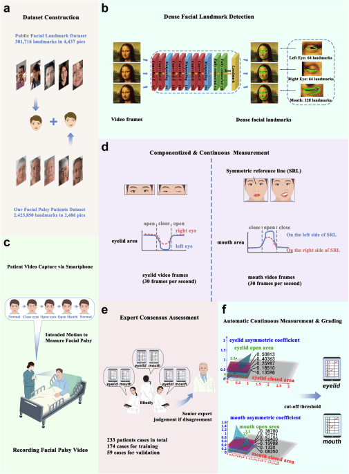 Continuous and componentized facial palsy measurement alignment and clinical interpretable model