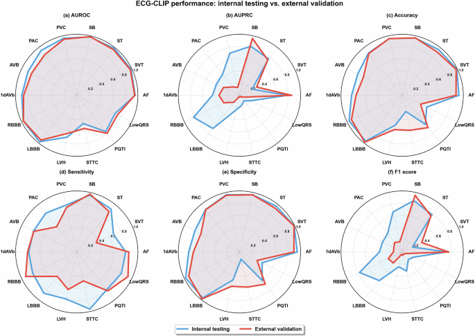 Diagnosis of cardiac conditions from 12-lead electrocardiogram through natural language supervision