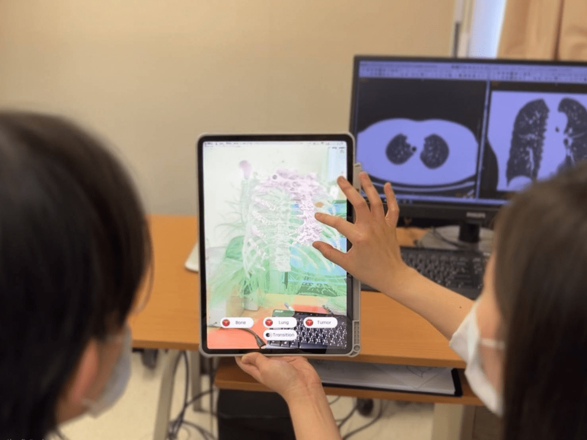 Effect of Mobile Augmented Reality Counseling on Improving Shared Decision-Making in Thoracic Surgery: Randomized Clinical Crossover Trial