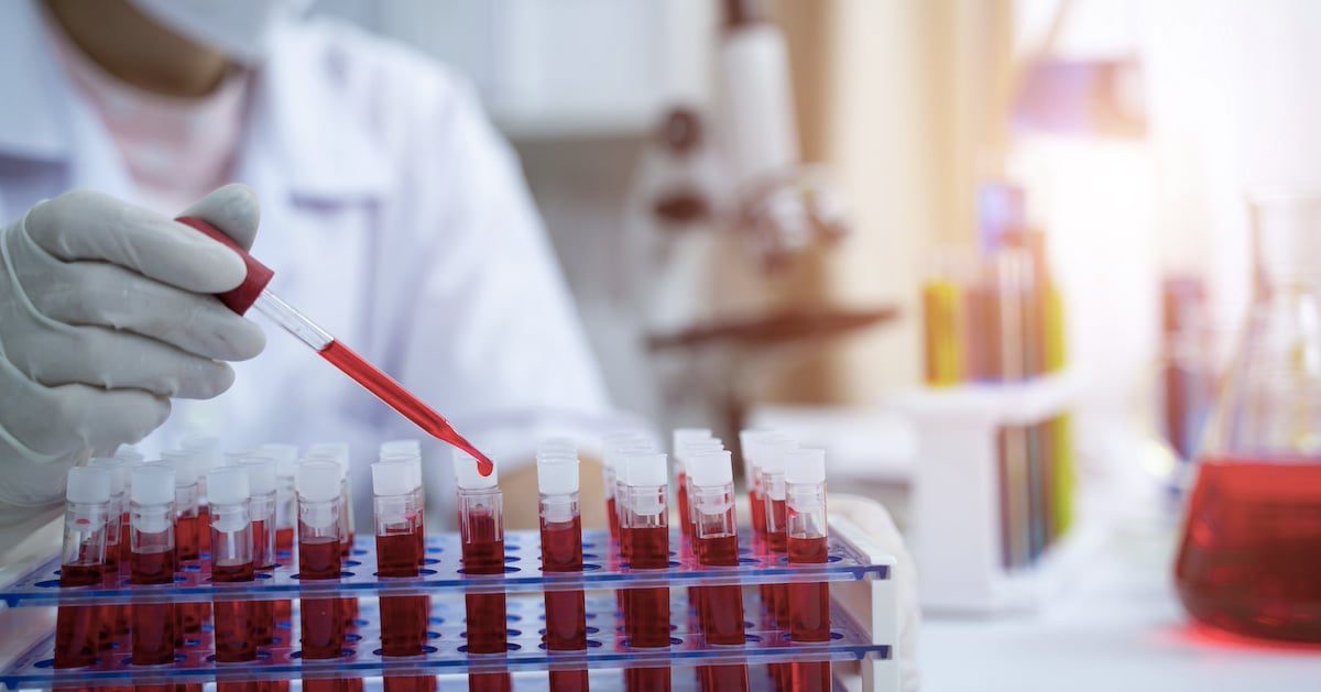 Freenome teams up with Roche for cancer screening tests