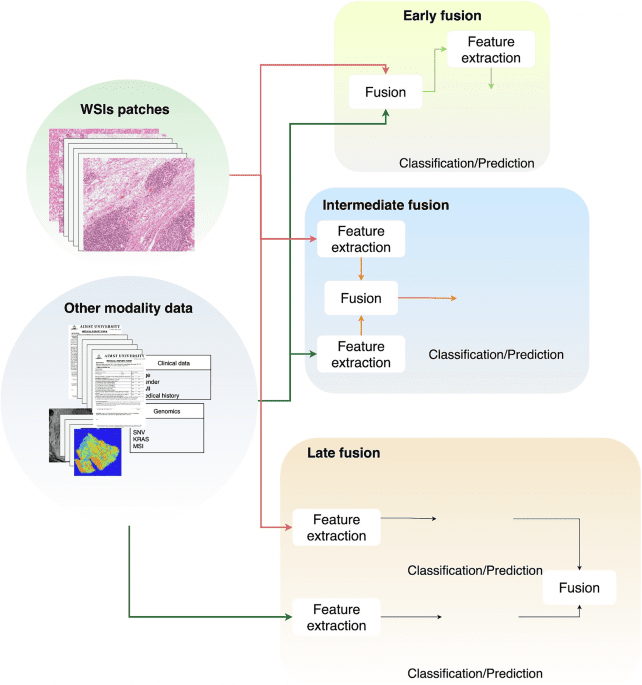 Multimodal analysis of whole slide images in colorectal cancer