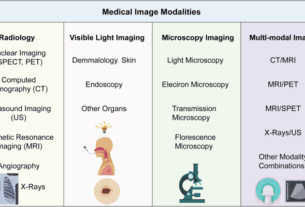 Research progress in computer-aided diagnosis systems for lung cancer