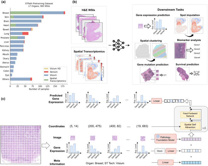 STPath: a generative foundation model for integrating spatial transcriptomics and whole-slide images