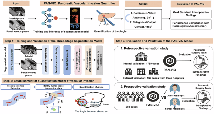 A clinically validated 3D deep learning approach for quantifying vascular invasion in pancreatic cancer