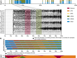An Automated Classifier of Harmful Brain Activities for Clinical Usage Based on a Vision-Inspired Pre-trained Framework