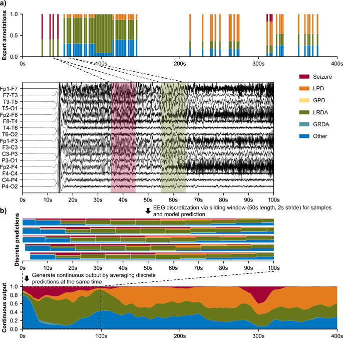 An Automated Classifier of Harmful Brain Activities for Clinical Usage Based on a Vision-Inspired Pre-trained Framework