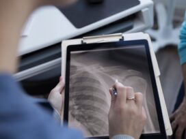 Korean AI explains osteoporosis risk from chest X-ray