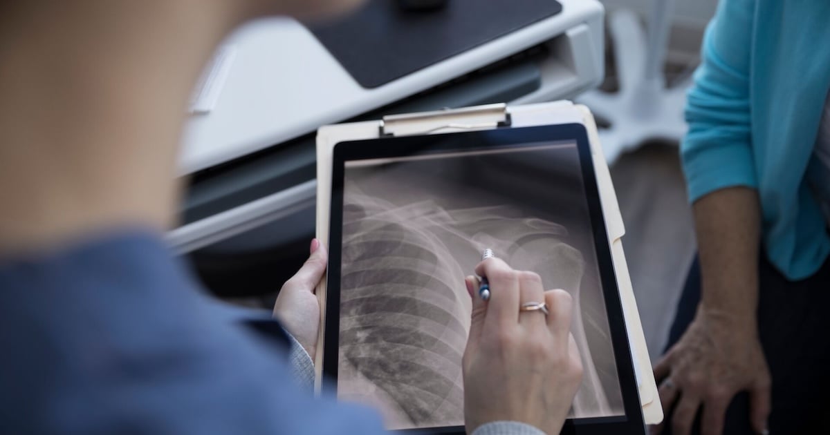 Korean AI explains osteoporosis risk from chest X-ray