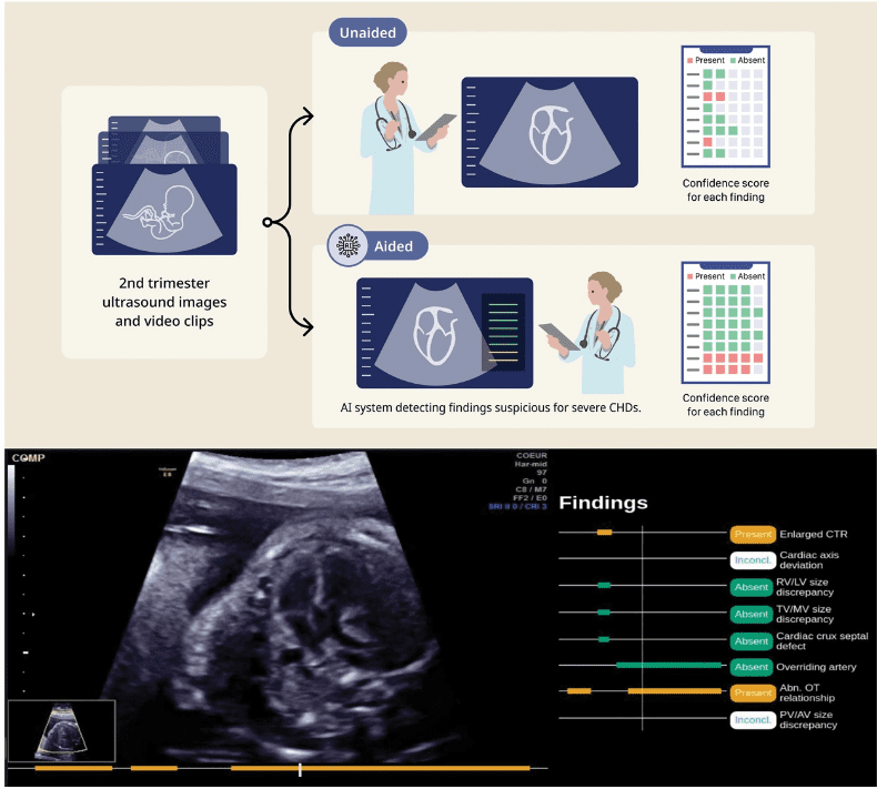 Mount Sinai Deploys AI-Enhanced Fetal Ultrasounds, Achieves Near-Perfect Detection Rates for Congenital Heart Defects