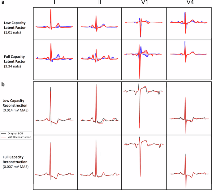 The cost of explainability in artificial intelligence-enhanced electrocardiogram models