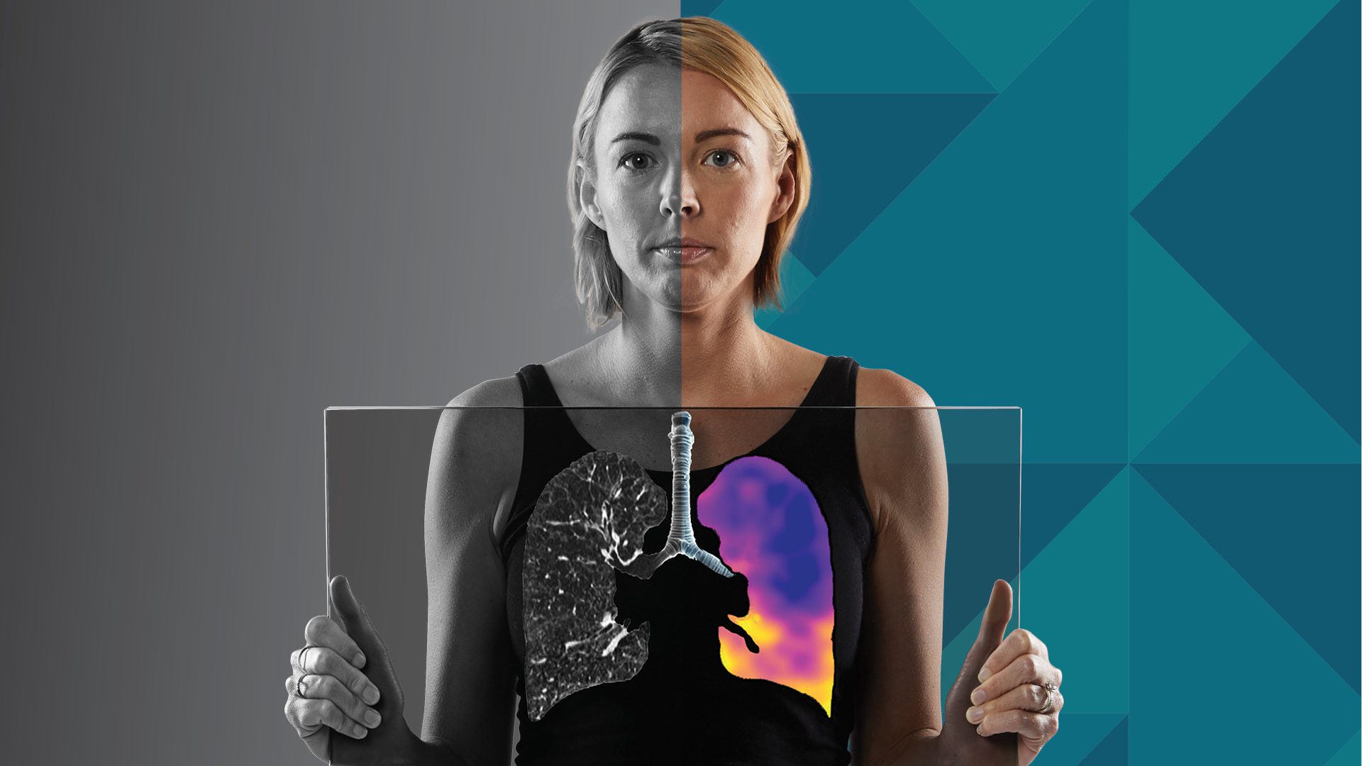 4DMedical Secures $100M+ to Scale U.S. Respiratory Imaging Rollout