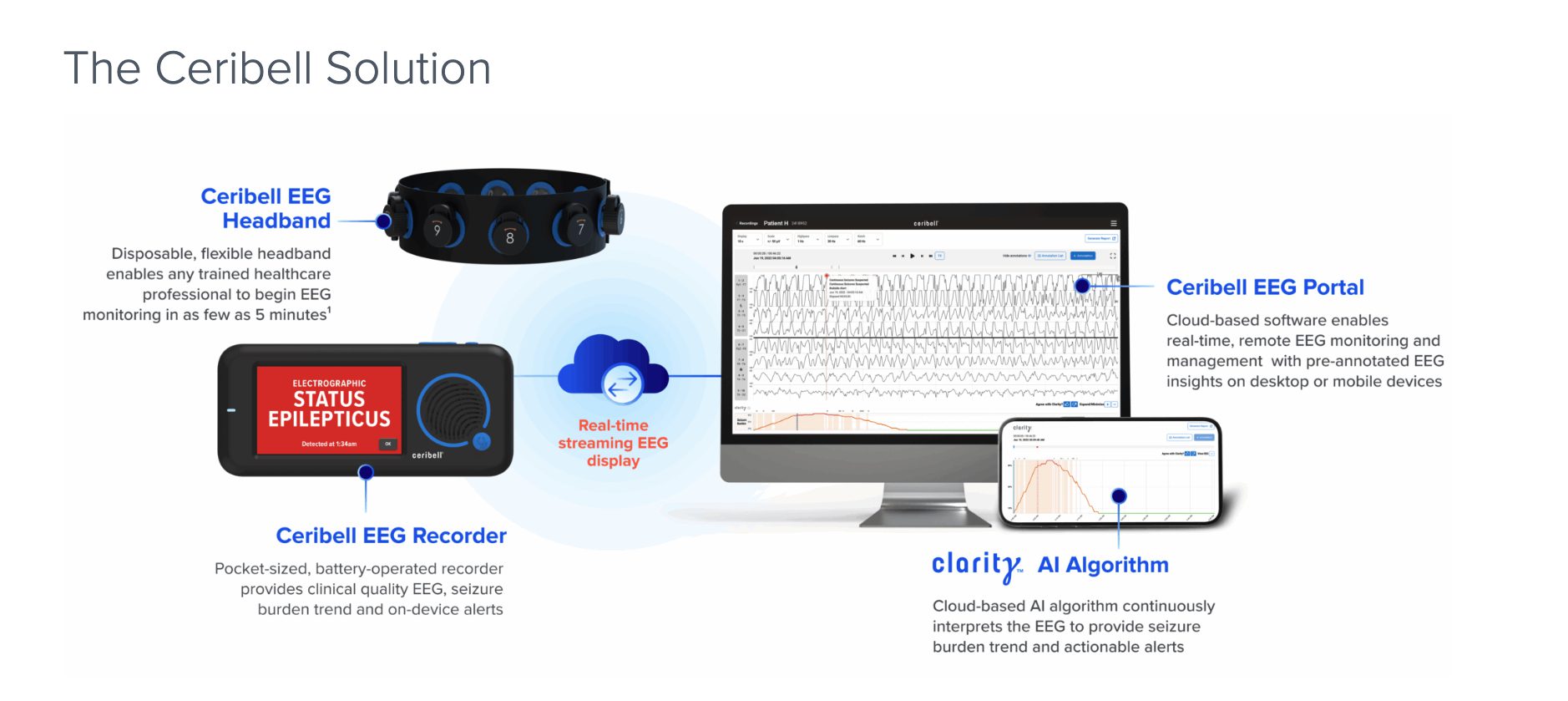 The EEG as a ‘Vital Sign’: Ceribell’s AI Pivot to In-Hospital Stroke Detection
