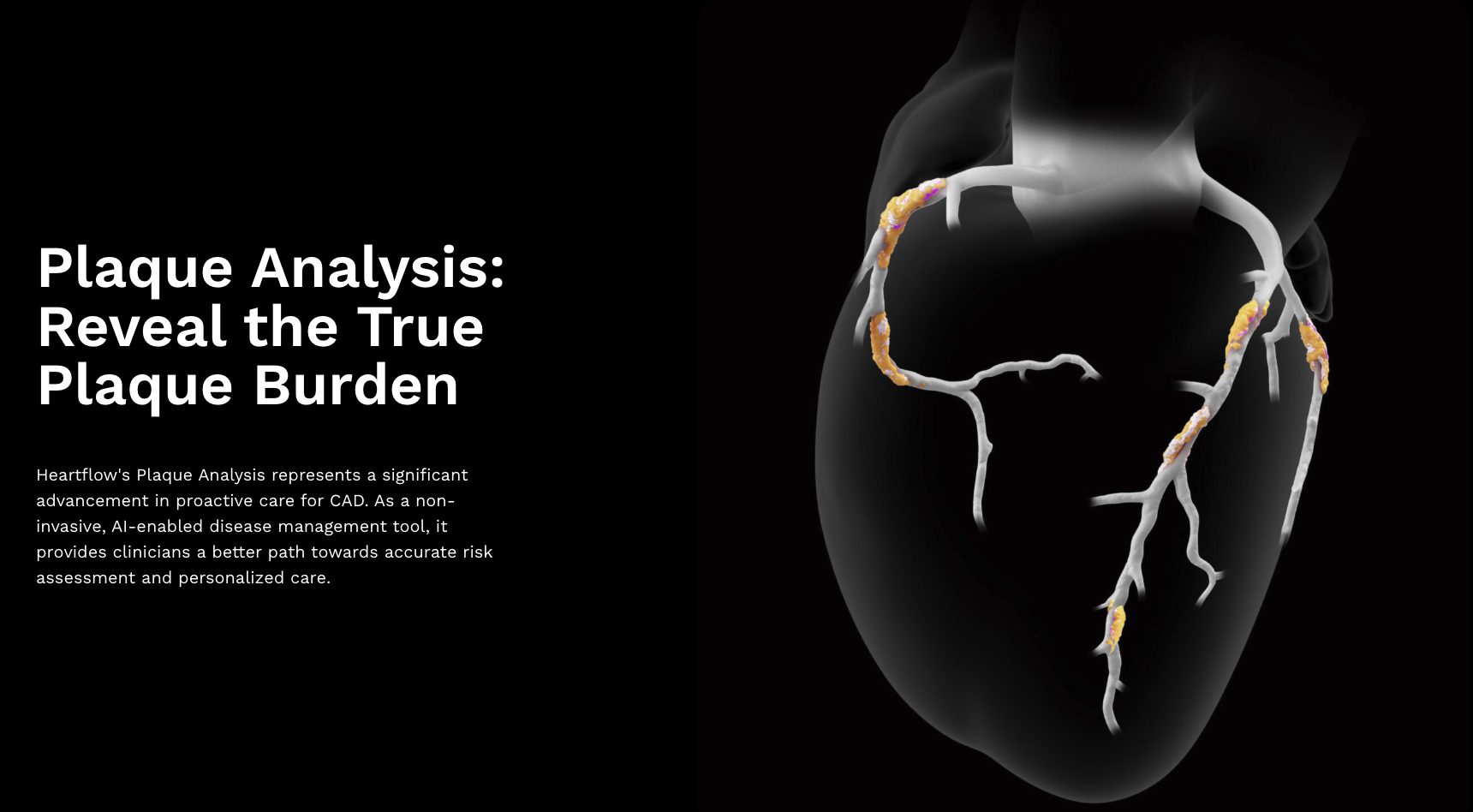 The Standard of Care Shift: Heartflow Secures Nationwide Aetna Coverage for AI Plaque Analysis